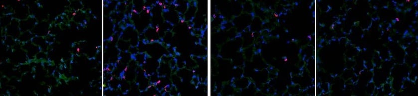 Our Comprehensive Guide to Performing Double Immunofluorescence