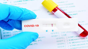 COVID-19 Antibody Testing