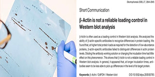 How to select loading controls for Western Blots?