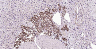 Immunohistochemical analysis of paraffin embedded human adrenal gland tissue slide using IHC0201H (Human CHGA IHC Kit).
