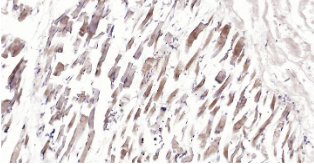 Immunohistochemical analysis of paraffin embedded human skeletal muscle tissue slide using IHC0202H (Human CRIM1 IHC Kit).