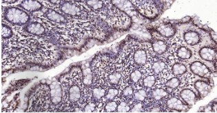 Immunohistochemical analysis of paraffin embedded human colon tissue slide using IHC0204H (Human Phospho-SRF (Ser77) IHC Kit).