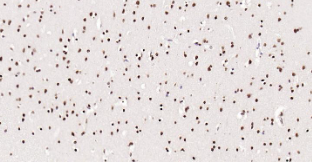 Immunohistochemical analysis of paraffin embedded human brain tissue slide using IHC0204H (Human Phospho-SRF (Ser77) IHC Kit).