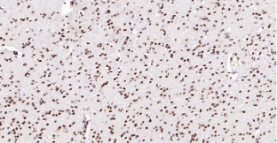 Immunohistochemical analysis of paraffin embedded mouse brain tissue slide using IHC0204M (Mouse Phospho-SRF (Ser77) IHC Kit).