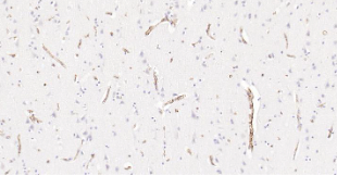 Immunohistochemical analysis of paraffin embedded human brain tissue slide using IHC0205H (Human HLA E IHC Kit).