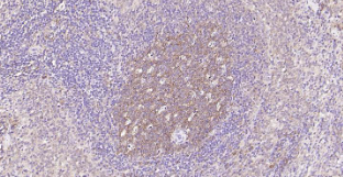 Immunohistochemical analysis of paraffin embedded rat spleen tissue slide using IHC0206R (Rat NFKB p65 IHC Kit).
