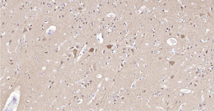 Immunohistochemical analysis of paraffin embedded human brain tissue slide using IHC0207H (Human PGP9.5 IHC Kit).