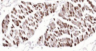 Immunohistochemical analysis of paraffin embedded human skeletal muscle tissue slide using IHC0208H (Human MYH1 IHC Kit).